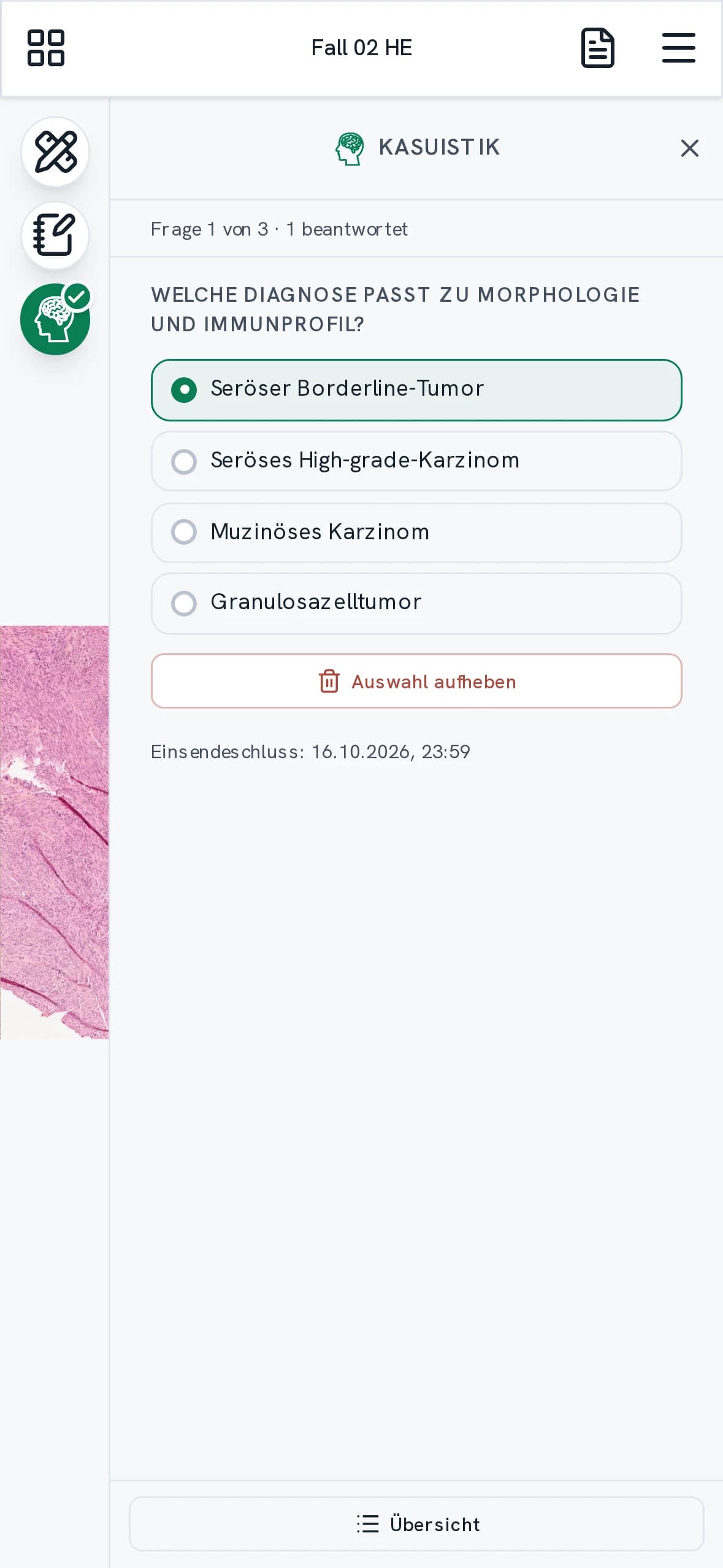 A case question on a phone beside the section, with answer options and a deadline