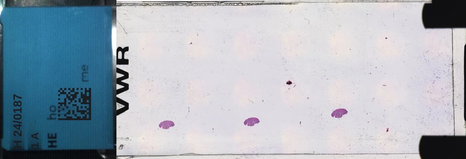 A glass slide as the scanner files it, with its blue label and three H&E punch biopsies on the glass